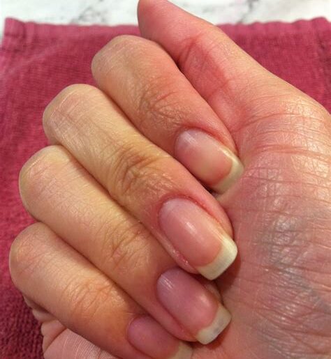 5 Nail Tips for Strong and Healthy Nails