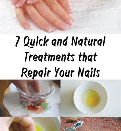 The Benefits of Natural Nail Treatments