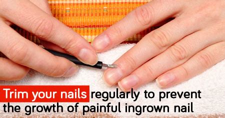 The Benefits of Regular Nail Trims
